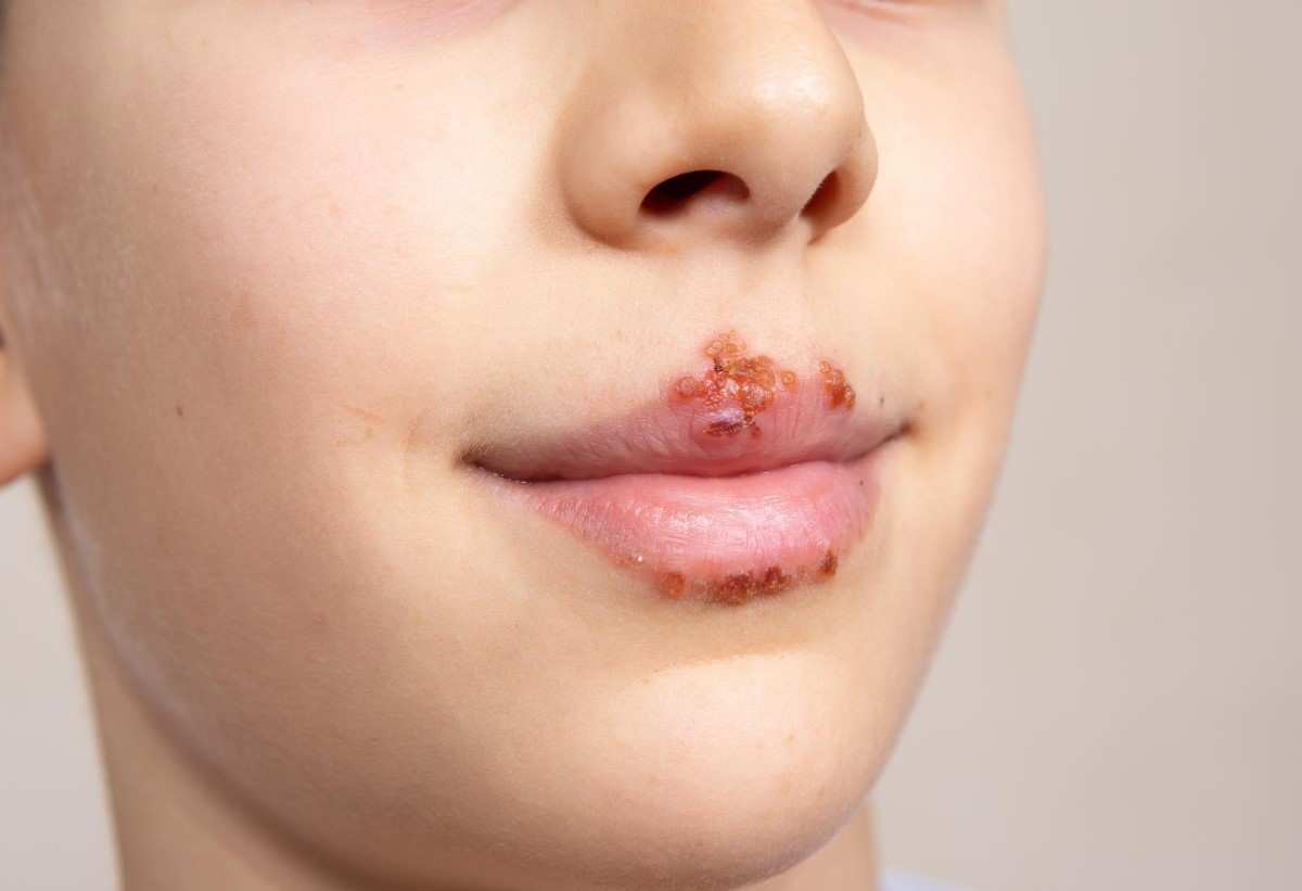 ayurvedic medicine for skin allergy