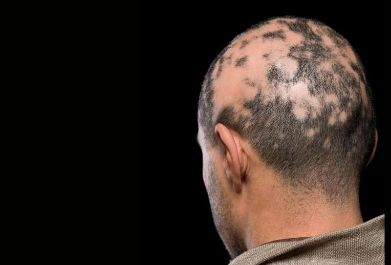 ayurvedic medicine for skin allergy