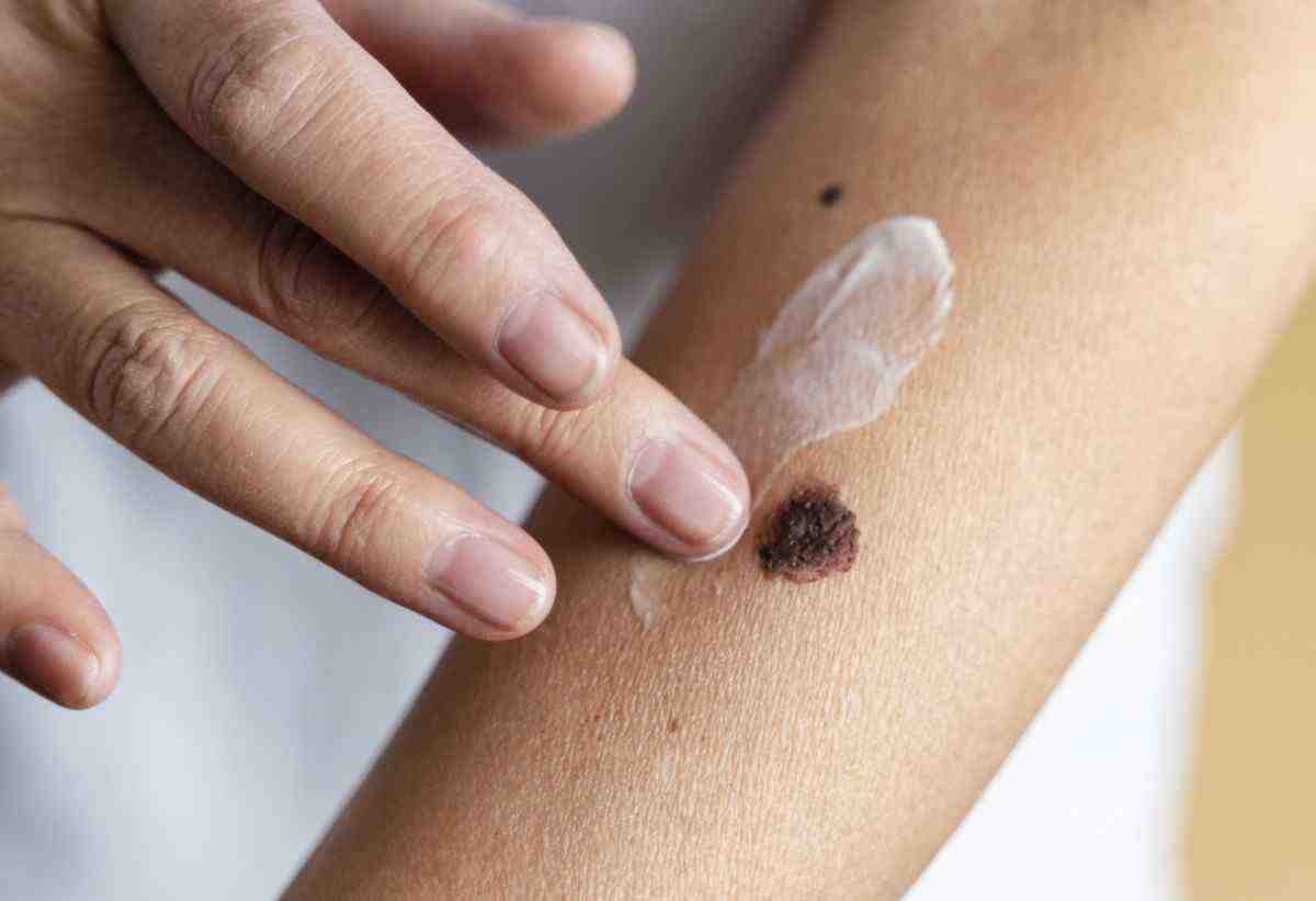 ayurvedic medicine for skin allergy