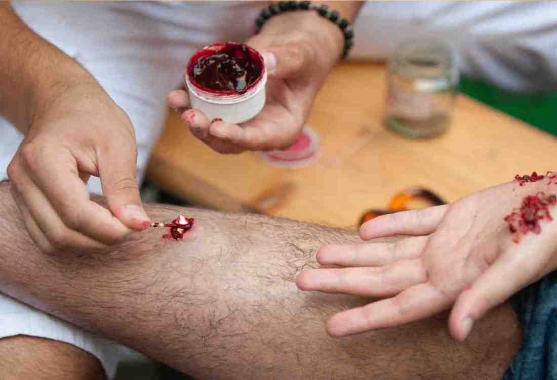 ayurvedic medicine for skin allergy