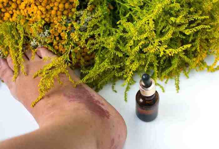 ayurvedic medicine for skin allergy