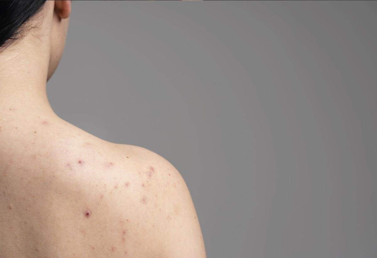 ayurvedic medicine for skin allergy