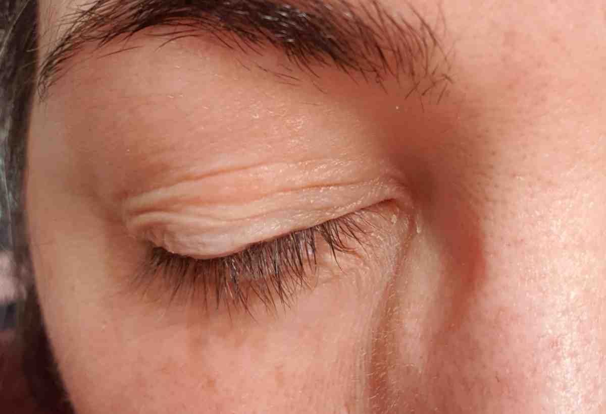 Best Ayurvedic eye exercises for vision