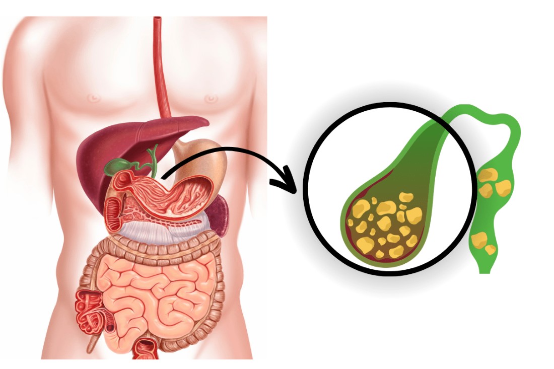 Ayurvedic treatment for digestive disorders