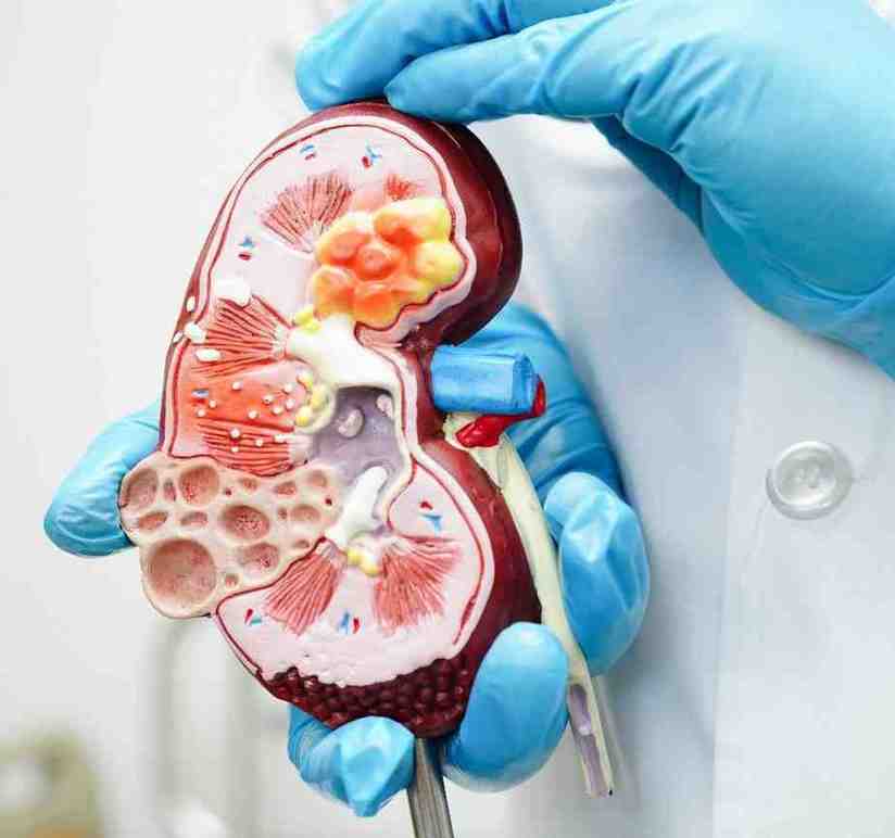 Ayurvedic Therapies for Kidney Health