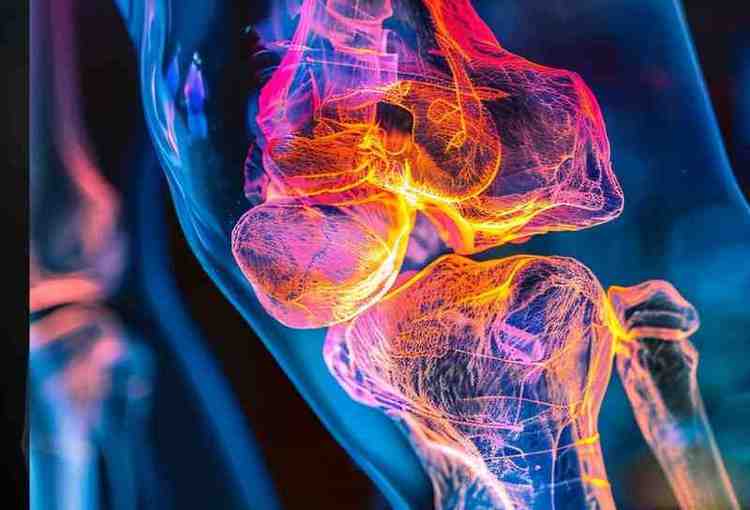 Ayurvedic Neurology Treatment