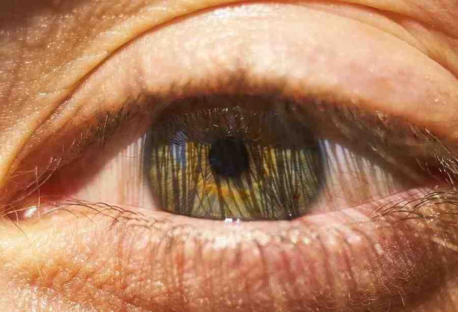 Natural Remedies for Eye Health