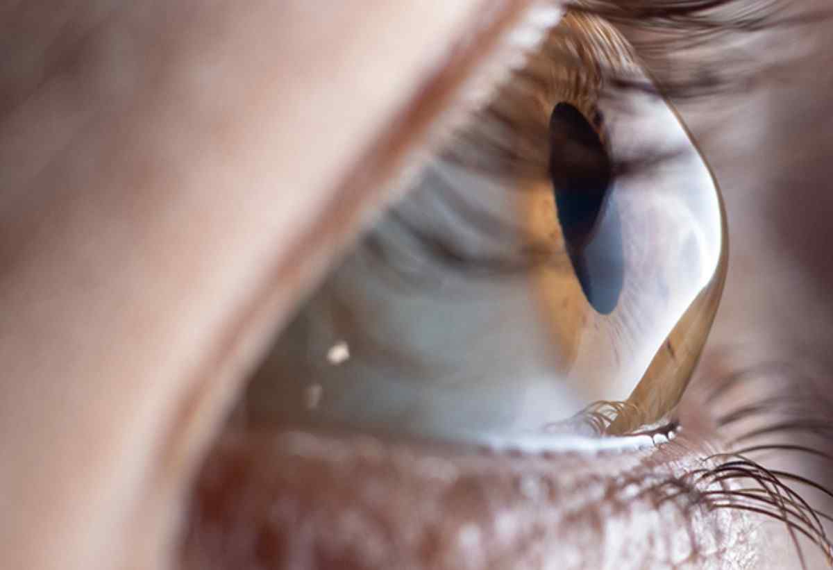 Natural Remedies for Eye Health