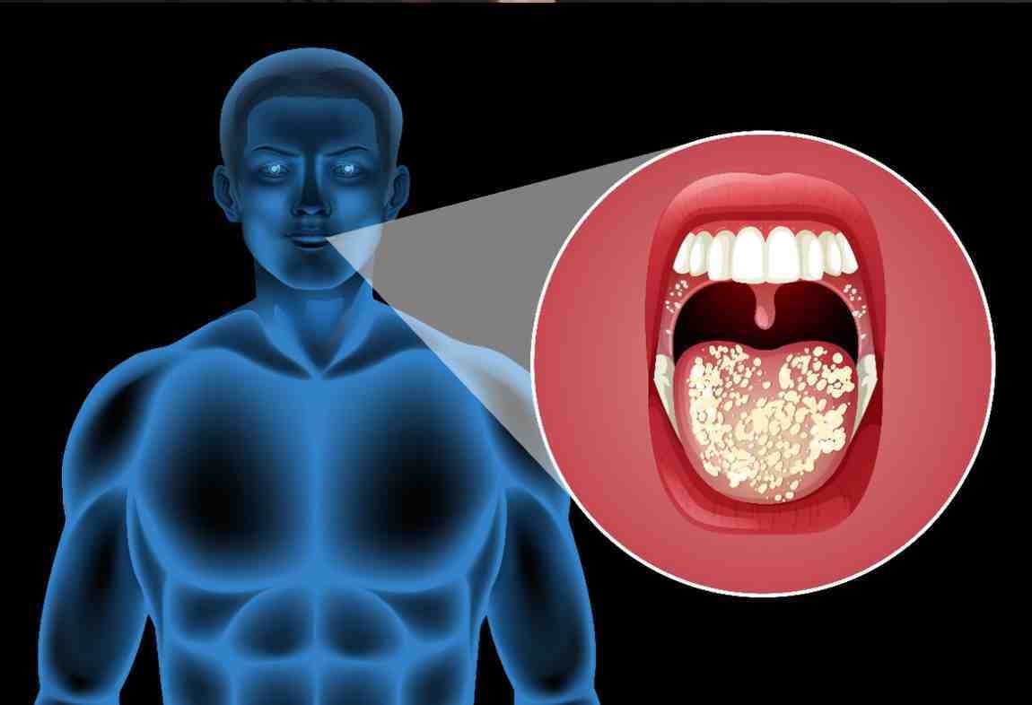 Ayurvedic Oral Detoxification