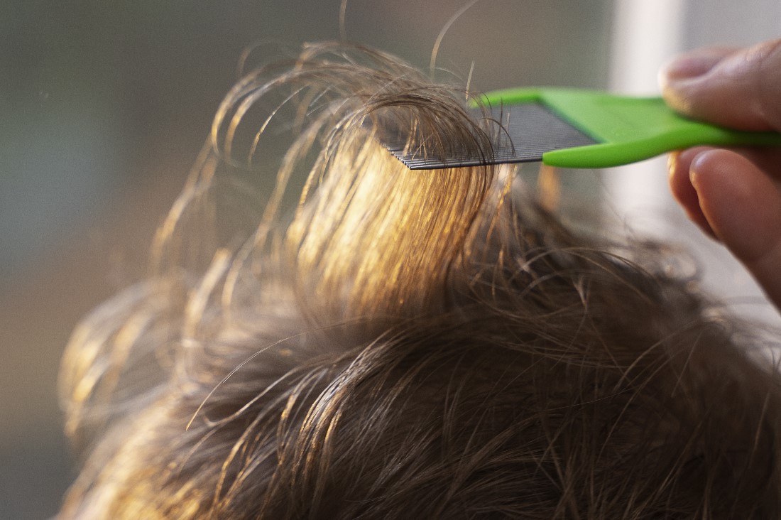 Ayurvedic Hair Treatment